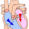 Diastole